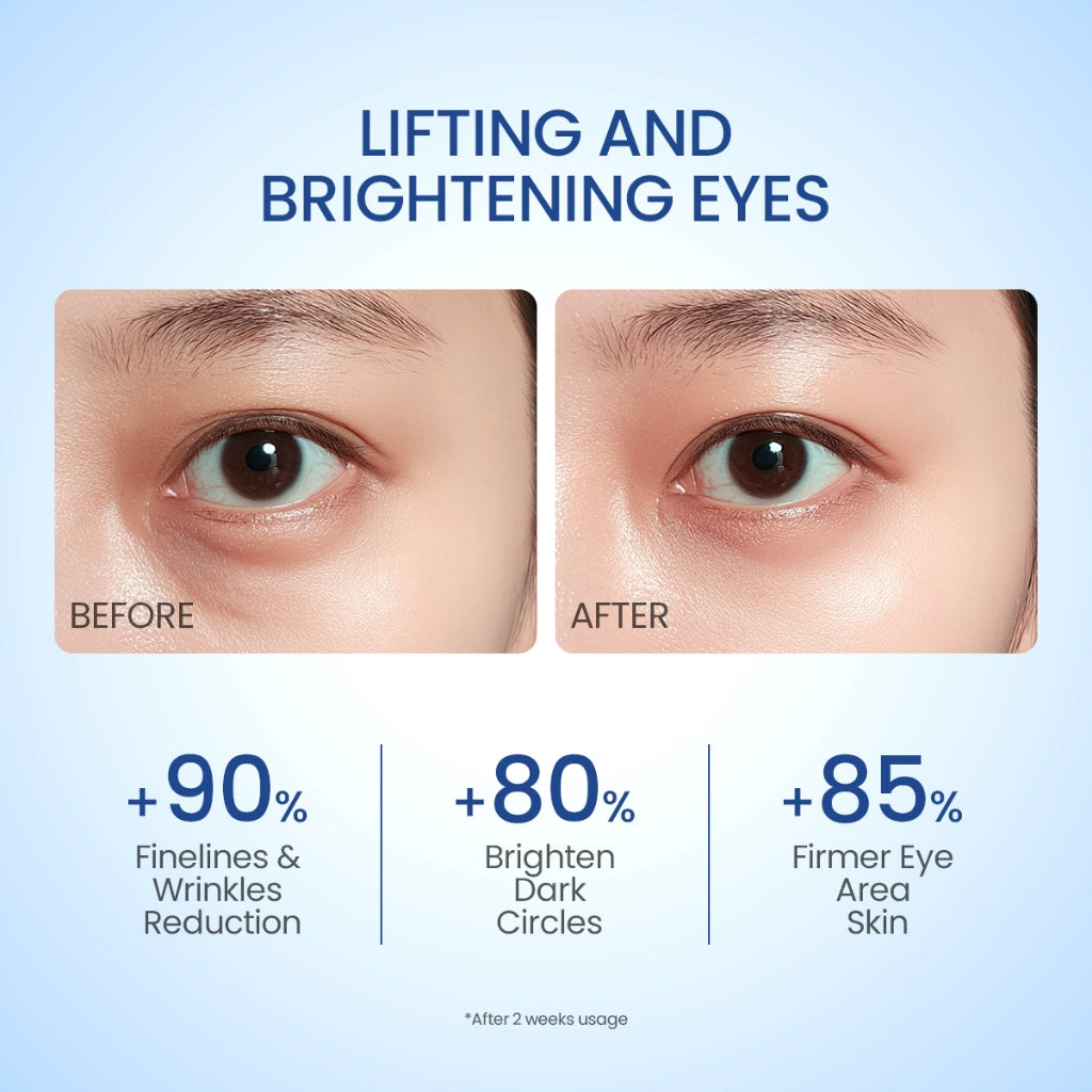 ELFORMULA Advanced Timeless Essential Eye Cream - Serum Mata untuk Mencerahkan Area Mata dan Mengurangi Garis Halus with Niacinamide and Peptides + Probiotic - Eye Serum Mata Panda