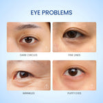 ELFORMULA Advanced Timeless Essential Eye Cream - Serum Mata untuk Mencerahkan Area Mata dan Mengurangi Garis Halus with Niacinamide and Peptides + Probiotic - Eye Serum Mata Panda