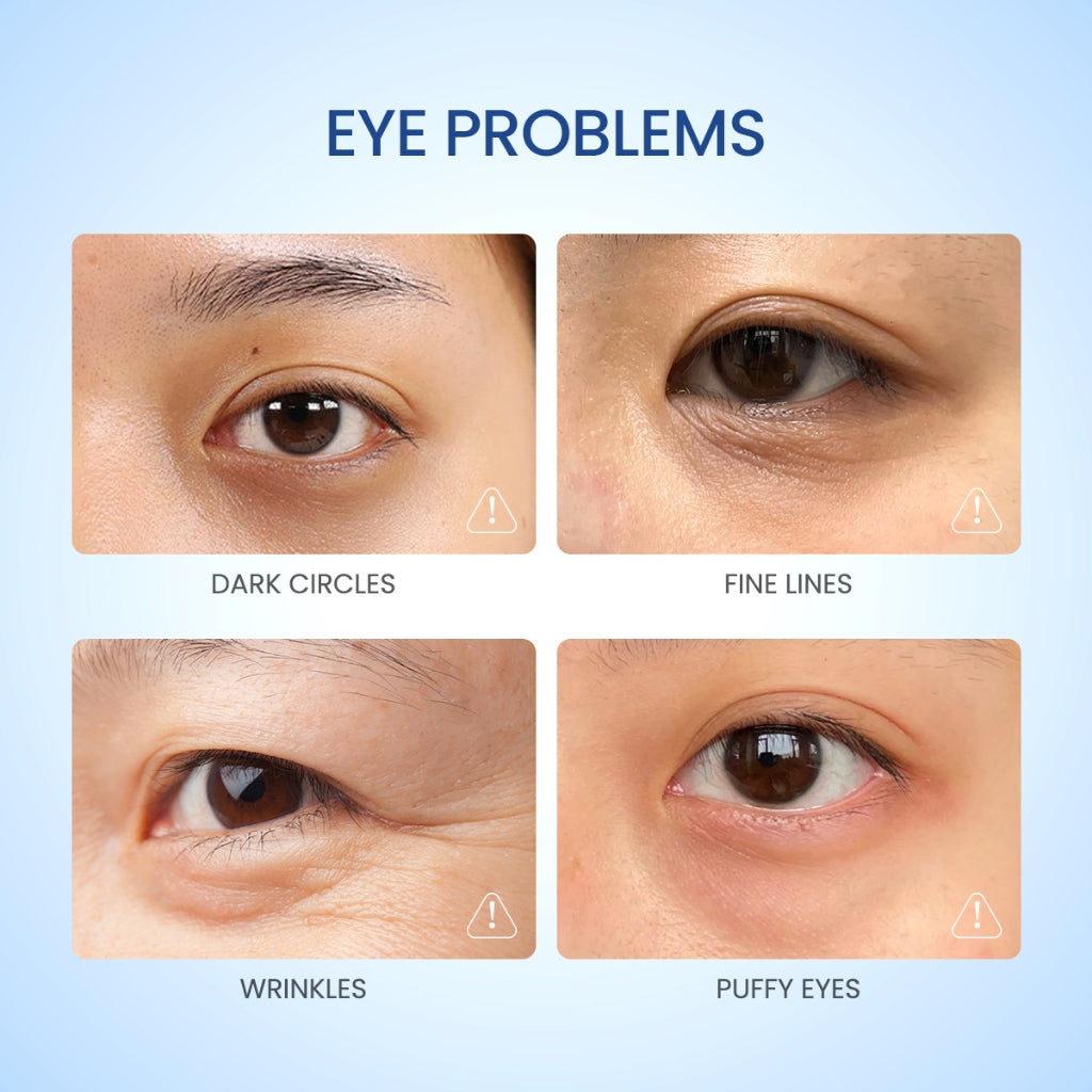 ELFORMULA Advanced Timeless Essential Eye Cream - Serum Mata untuk Mencerahkan Area Mata dan Mengurangi Garis Halus with Niacinamide and Peptides + Probiotic - Eye Serum Mata Panda