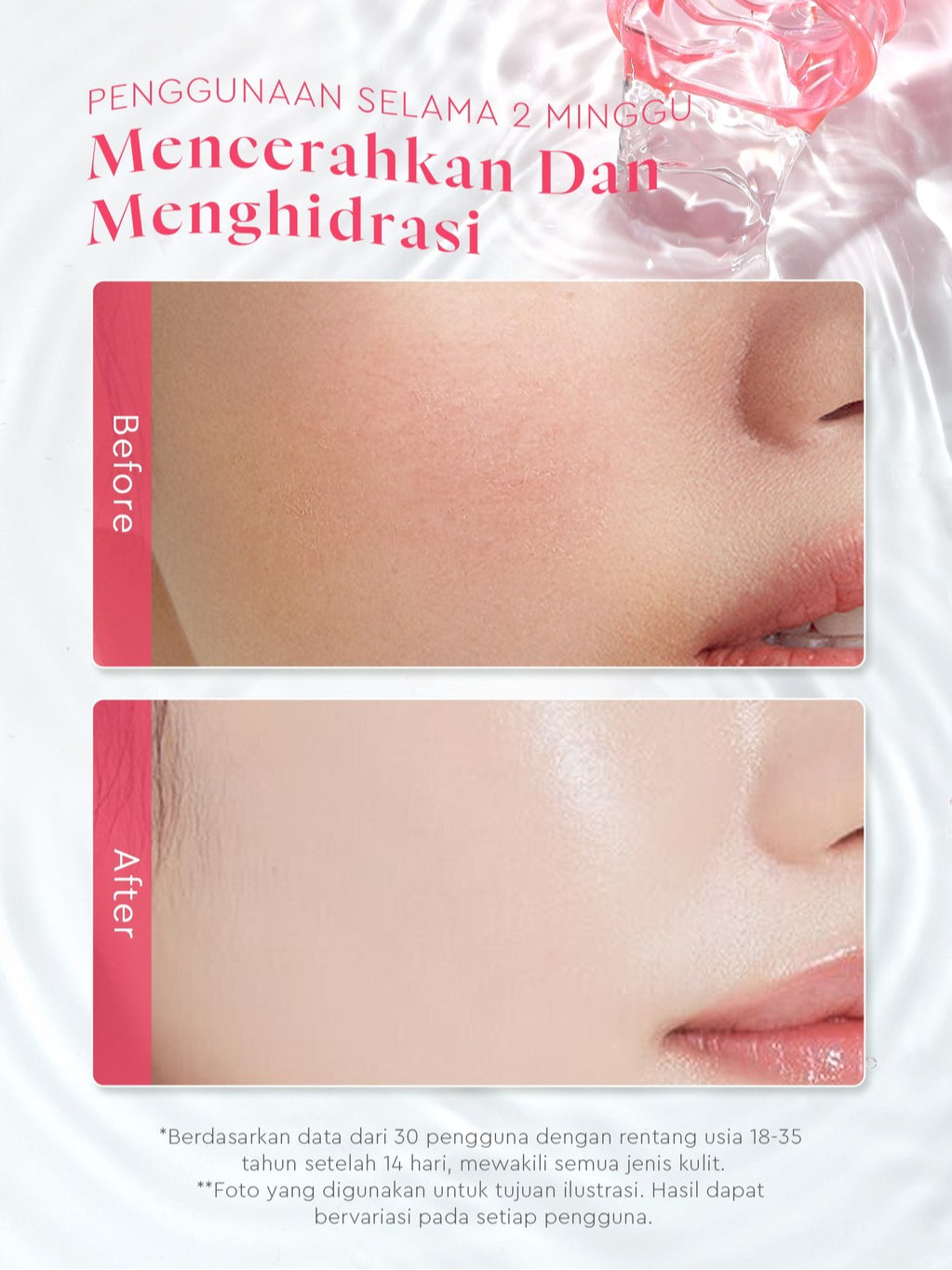 Glad2Glow Toner Complete Series 80ml-Brighten/Acne Toner/Barrier/Exfoliating toner-Skincare toner badan face mist hydrating toner centella toner wajah eksfoliasi water g2g toner hydrating gloglowing brightening exfoliasi glycolic madeca g2g official store