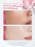 Glad2Glow Toner Complete Series 80ml-Brighten/Acne Toner/Barrier/Exfoliating toner-Skincare toner badan face mist hydrating toner centella toner wajah eksfoliasi water g2g toner hydrating gloglowing brightening exfoliasi glycolic madeca g2g official store