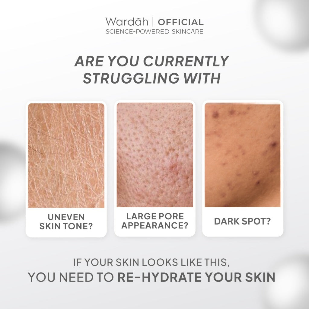 NEW! Wardah Alpha Arbutin Translussence Illuminating Essence Toner 50 ml Mencerahkan Kulit Menghilangkan Dark Spot Menghidrasi Kulit Ceramide dan Melembutkan Tekstur Wajah Untuk Semua Jenis Kulit - Toner Badan - Skincare