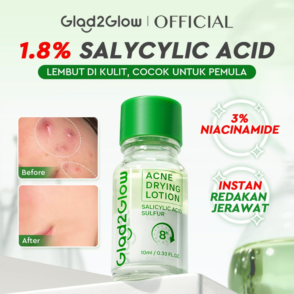 GLAD2GLOW Acne Drying Lotion Mengeringkan Jerawat 8 Jam Dengan Sulfur BHA & Bahan Alami Instant Acne Care Acne Gel Patch Spot Jerawat Serum Moisturizer Acne Skincare Wajah face wash facial Salicylic Acid Niacinamide g2glow official store