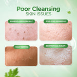 [NEW LAUNCH] ACNAWAY Mugwort Clay to Foam Cleanser 2-in-1 – Sabun Cuci Muka & Masker Wajah Anti Jerawat | Bersihkan Komedo, Mengurangi Minyak, Menenangkan Kulit Sensitif