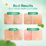 ACNAWAY Mugwort Water Gel Moisturizer - Moisture Gel Pelembab Wajah Untuk Kulit Berjerawat Acne Friendly Melembapkan Wajah Sensitif Cooling Soothing Gel Untuk Kulit Kemerahan Acne Prone Daily Moist Anti Acne Cepat Menyerap Skincare Calming Centella Cream