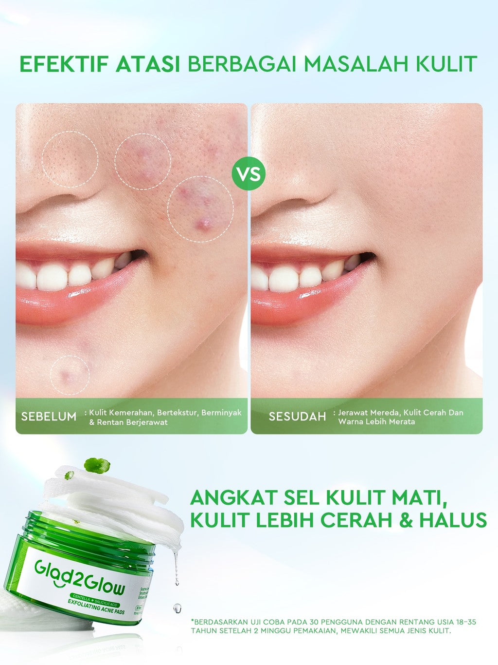 Glad2Glow Centella Salicylic Acid Exfoliating Acne Toner Pads Gentle Eksfoliasi Kulit Jerawat Kulit Sensitif (30 pads) Centella Pads Lactic Acid Malic AHA BHA Peeling Serum Acne Spot Serum Cica Acne Clear Pad Treatment Jerawat exfoliasi wajah obat jerawat
