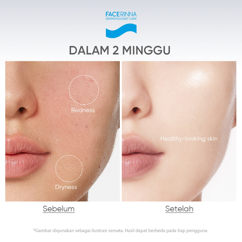 FACERINNA Ceramide B5 Balancing Toner 100 ml | Ceramide Soothing Calming Toner Hyaluronic acid Barrier Essence Toner Memperbaiki penghalang kulit Jaga kulit After-sun Hydrating Sensitive Barrier Care Skincare | Eksfoliasi Wajah Glycocid Acid Glycolic Acid