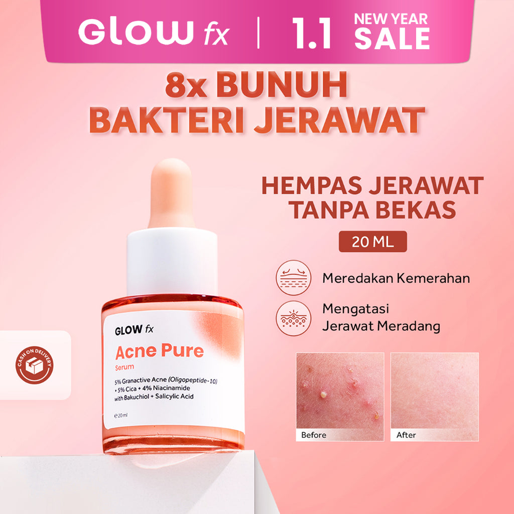 [Single Pack] GLOW FX Acne Pure Serum - Serum Untuk Jerawat Meradang