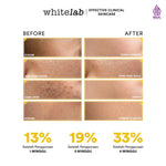Whitelab Paket Wajah Brightening Niacinamide Facial Wash, Toner, Serum, Moisturizer, Sunscreen, Sleeping Mask - 7 pcs N-Dose+ 2.0 Skincare