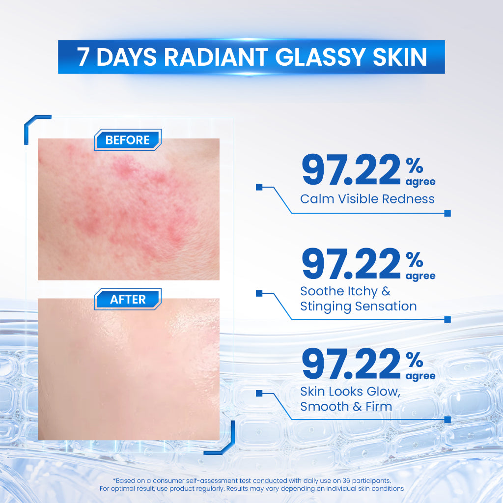 [NEW] Y.O.U BARRIER SHIELD Probiotic Balance Serum 20 ml | Barrier Serum PDRN Glass Skin | 1000pm PDRN | Microbiome | Serum PDRN