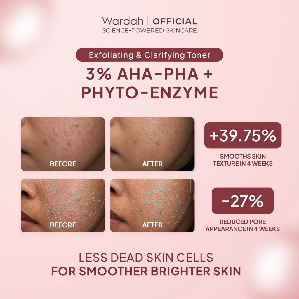 NEW! Wardah 3% AHA-PHA Phyto-Enzyme Exfoliating & Clarifying Toner 100 ml-Mengangkat Sel Kulit Mati, Mencerahkan dan Melembukan Kulit Tanpa Sensasi Cekit-Cekit dan Tanpa Sensasi Terbakar - Skincare