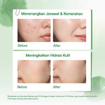 Glowsophy Bundle 3Pcs CICA Panthenol Soothing Moisturizer Calming Redness Mugwort Gel Day and Night Skincare 100 ml Gel Pelembab Kulit Berjerawat Membantu Menenangkan Jerawat Kemerahan