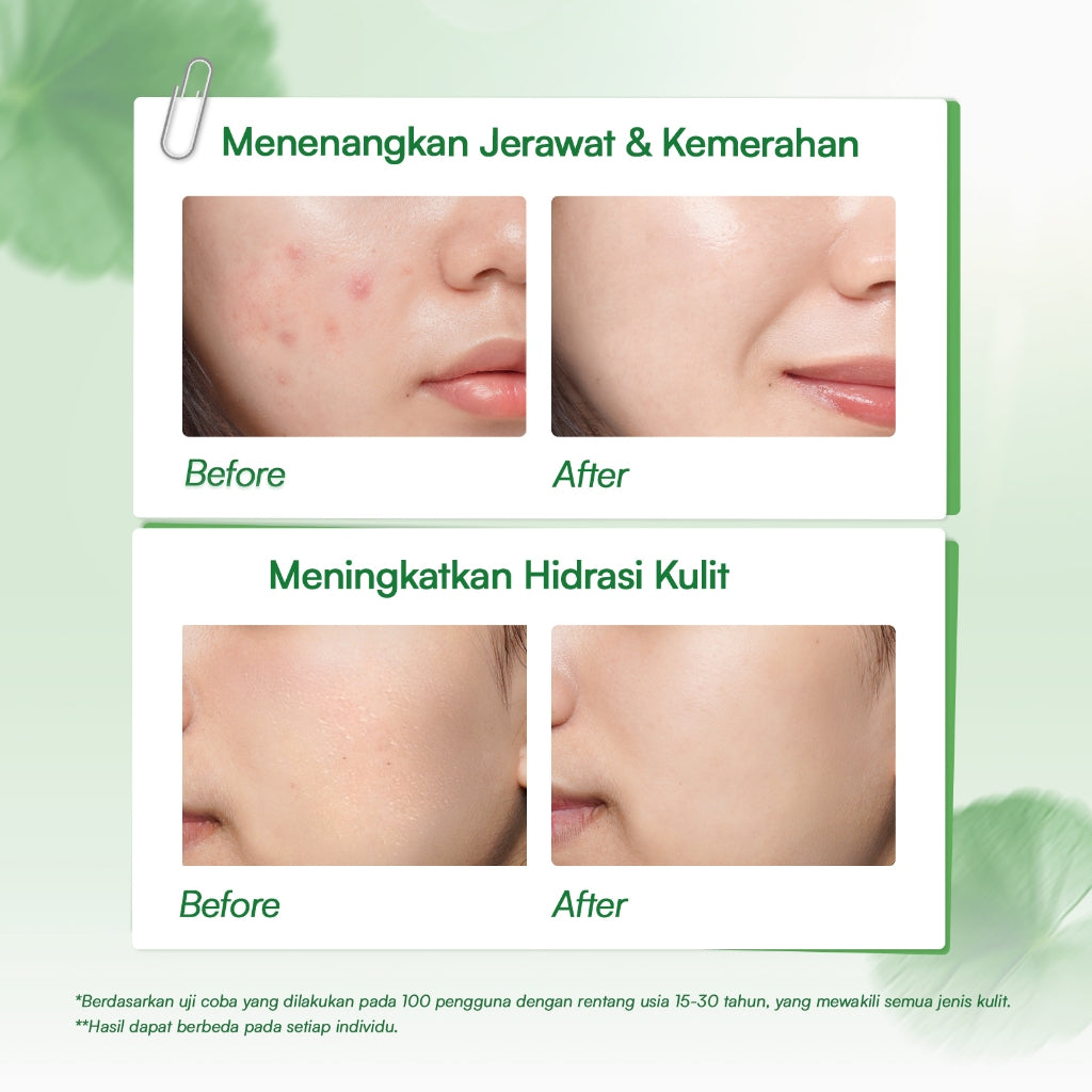 Glowsophy Bundle 2Pcs CICA Panthenol Soothing Moisturizer Calming Redness Mugwort Gel Day and Night Skincare 100 ml Gel Pelembab Kulit Berjerawat Membantu Menenangkan Jerawat Kemerahan