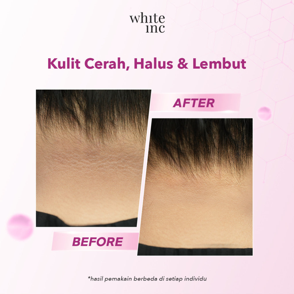 [100ml] WHITE INC Alpha Glowhite Body Serum | Kulit Cerah Halus dan Lembut