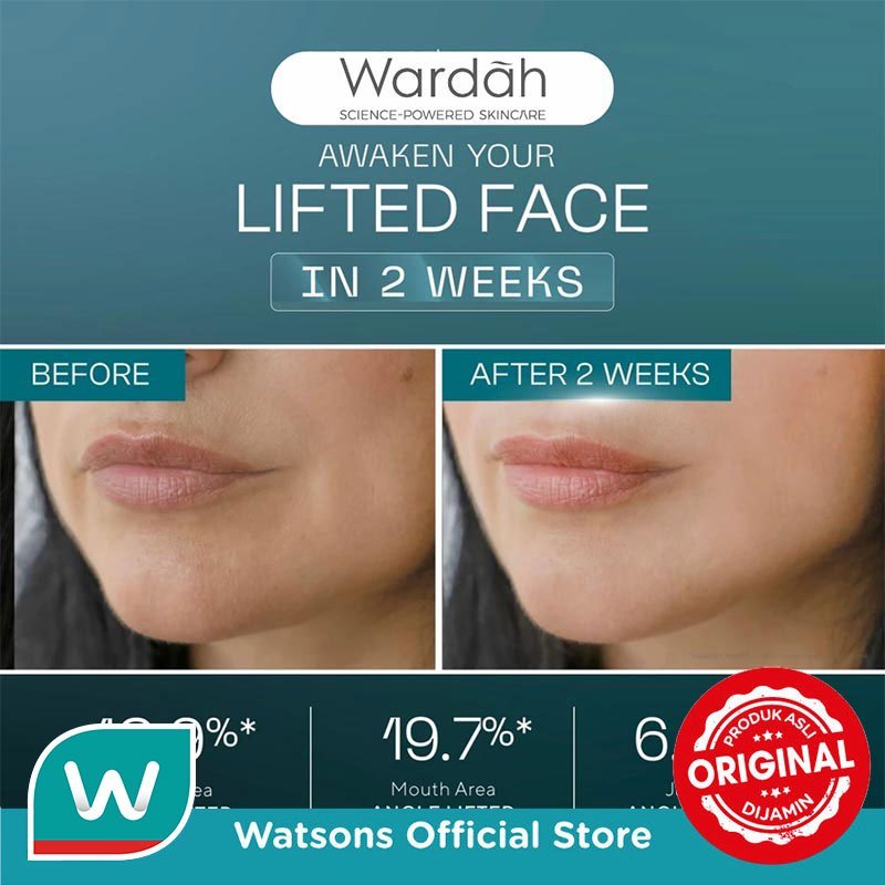Wardah Exosome + PDRN Lift Regenerating Serum 30ml - Serum Wajah - Glass Skin, Serum Mencerahkan Wajah, Clinic Treatment Serum dengan Salmon DNA - Hifu Result - Glowing