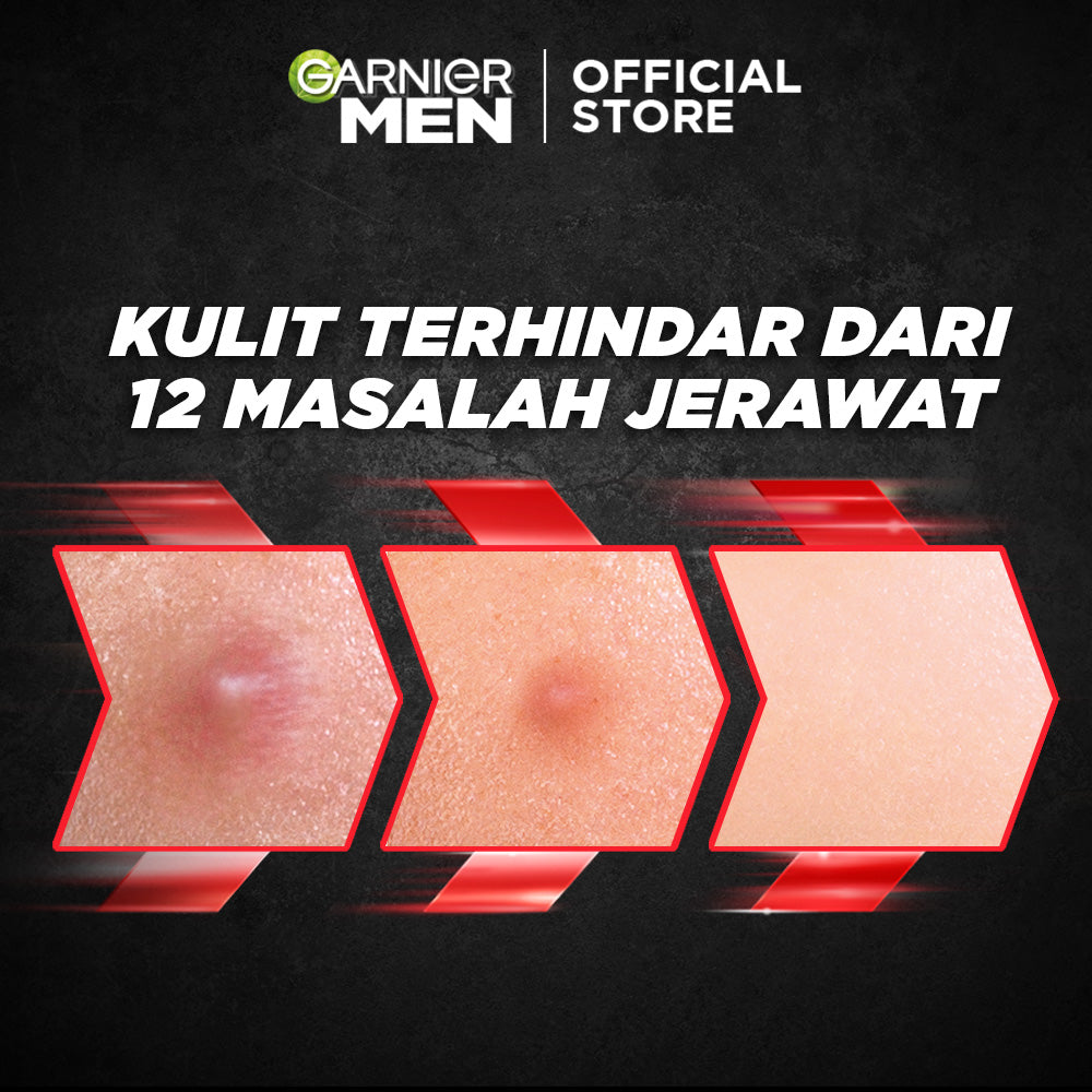 GARNIER Men Acno Fight Acne Fighting Brightening Serum Cream Skin Care - 40ml Krim Siang moisturizer tone up pelembab wajah day cream pemutih wajah glowing cepat