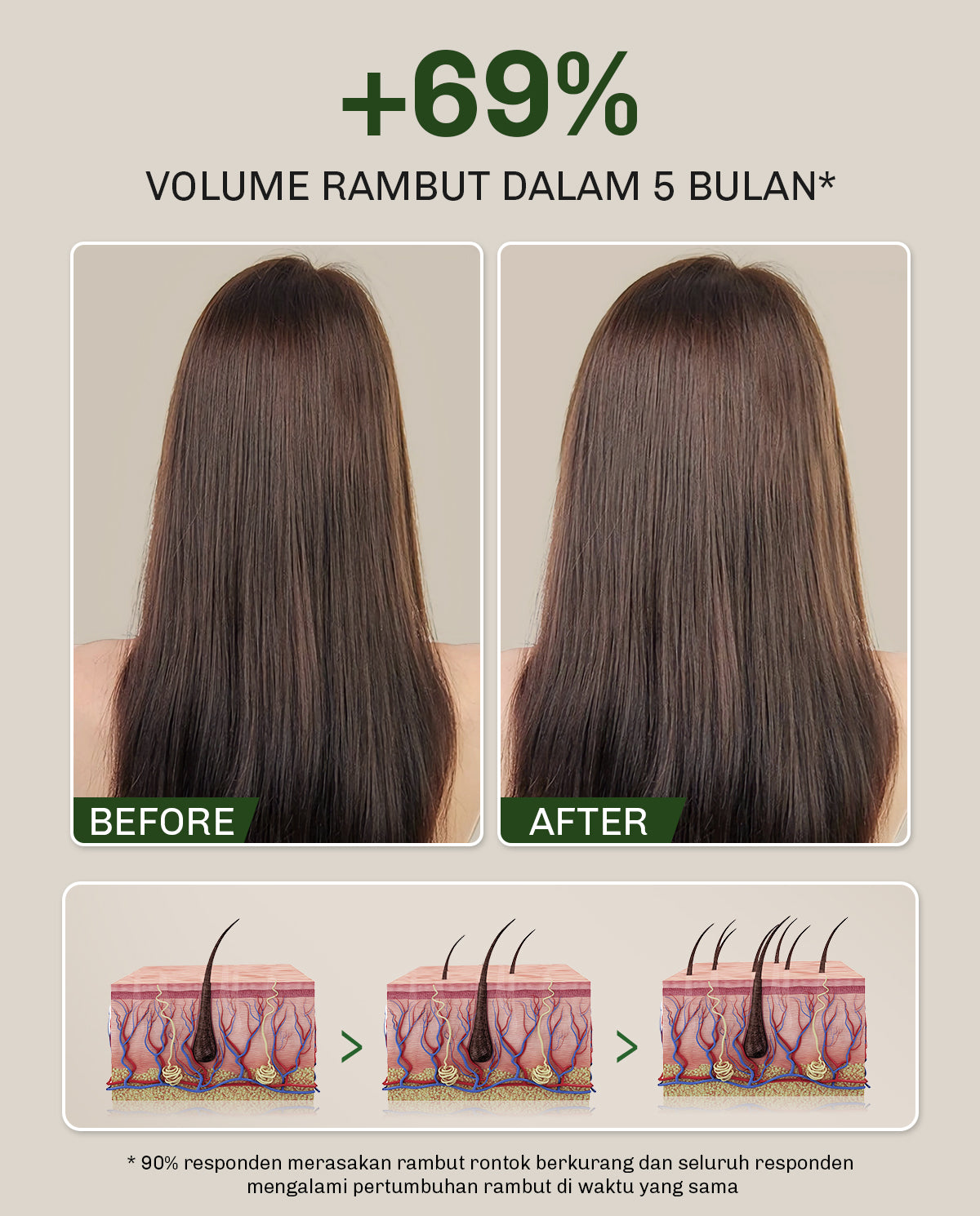 [BUNDLE] Lavojoy Hold Me Tight Pro Shampoo + Conditioner Spring Wonder | Hair Treatment | Perawatan Intensif untuk Rambut Rontok | Perawatan Rambut | Ceramide | Salicylic Acid | Hair Care | Citric Acid