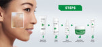 Whitelab 5 pcs Paket Acne Lengkap - Facial Wash, Toner, Serum, Moisturizer, Acne Cream Paket Skincare