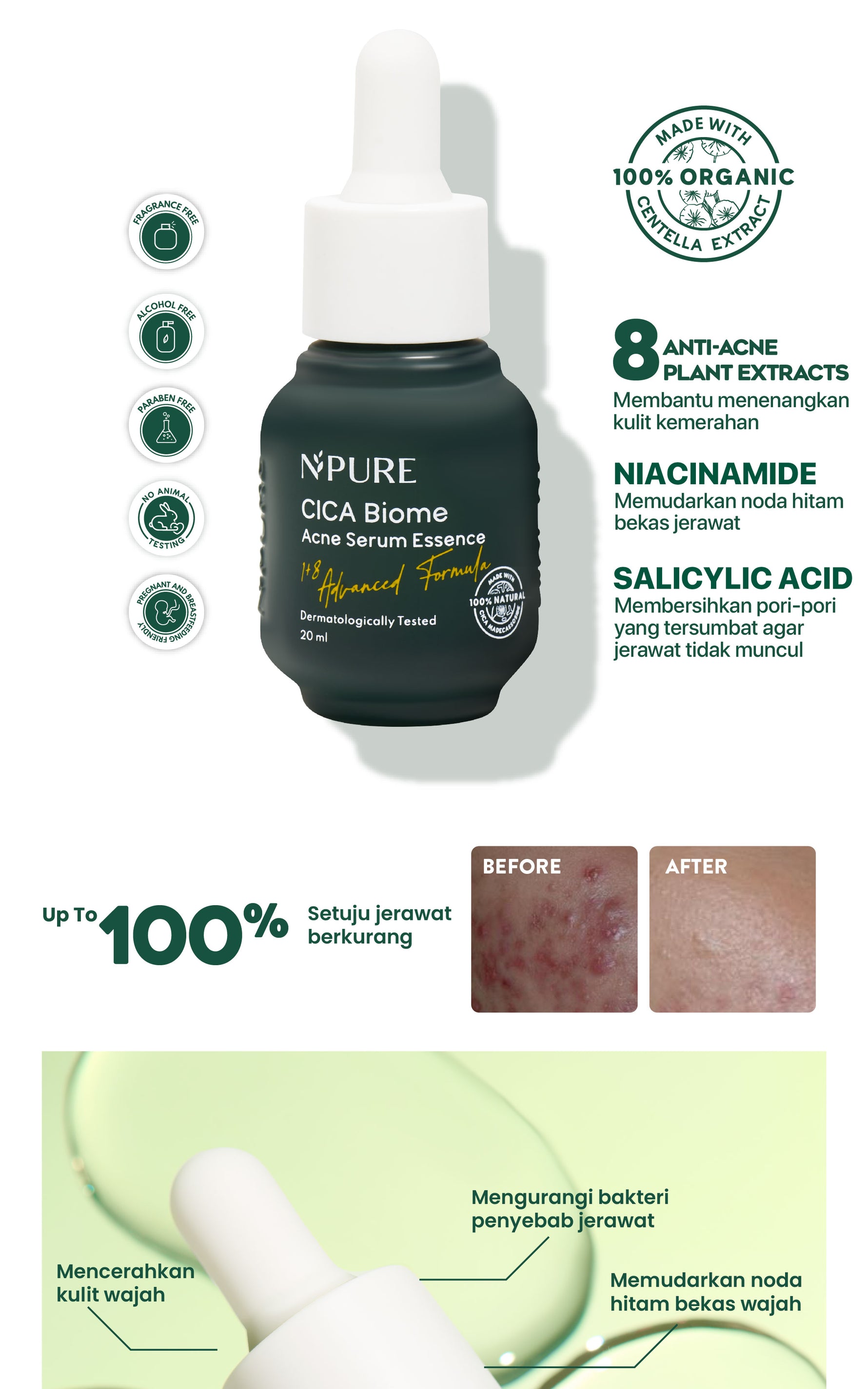 NPURE Anti Acne Serum / Serum Anti Jerawat / Kulit Berminyak / Serum Wajah Bebas Jerawat