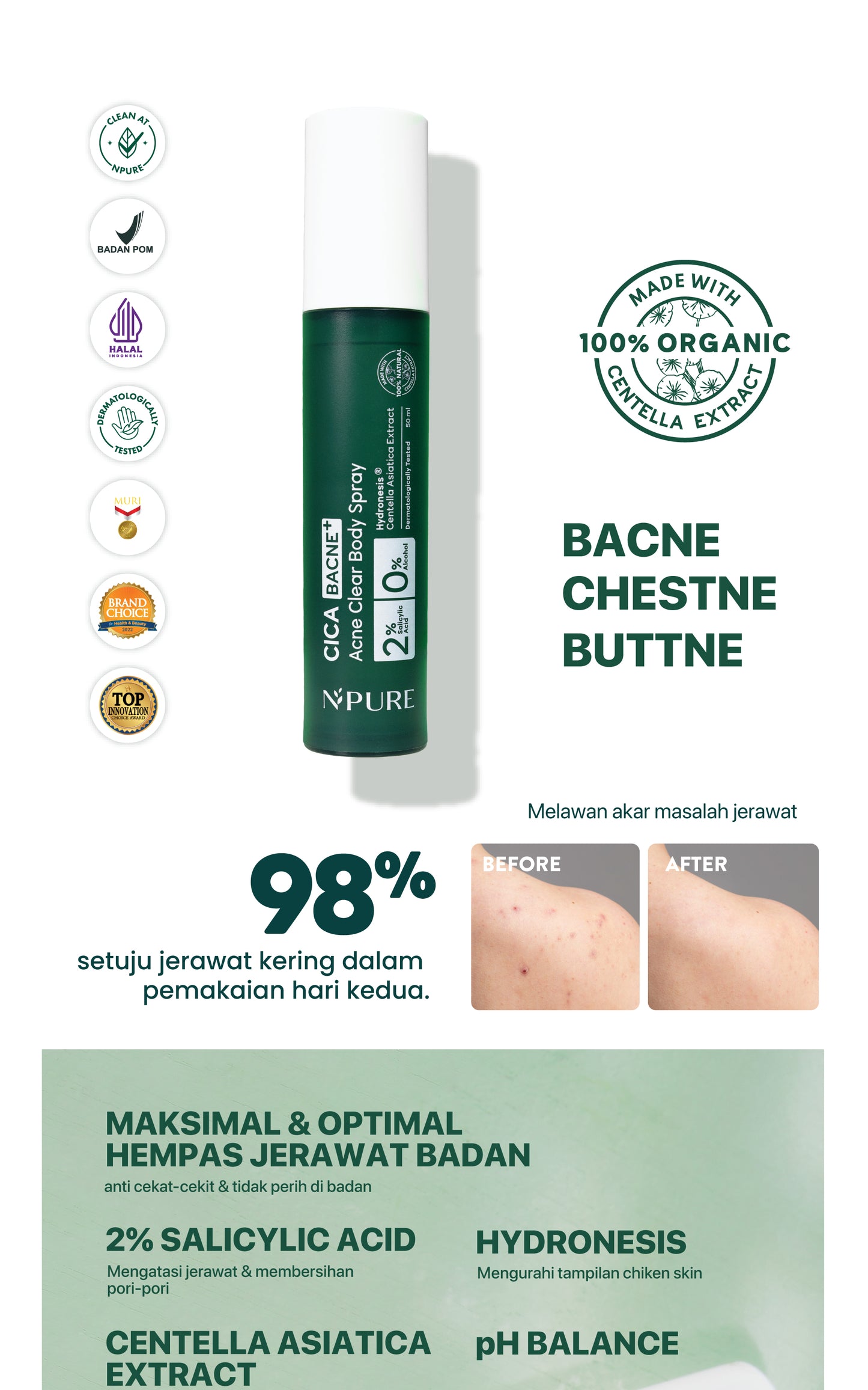 NPURE Bacne Spray /Jerawat Punggung & Badan / Chicken Skin / Keratosis Pilaris / Salicylic Acid 2% / Aman Kulit Sensitif