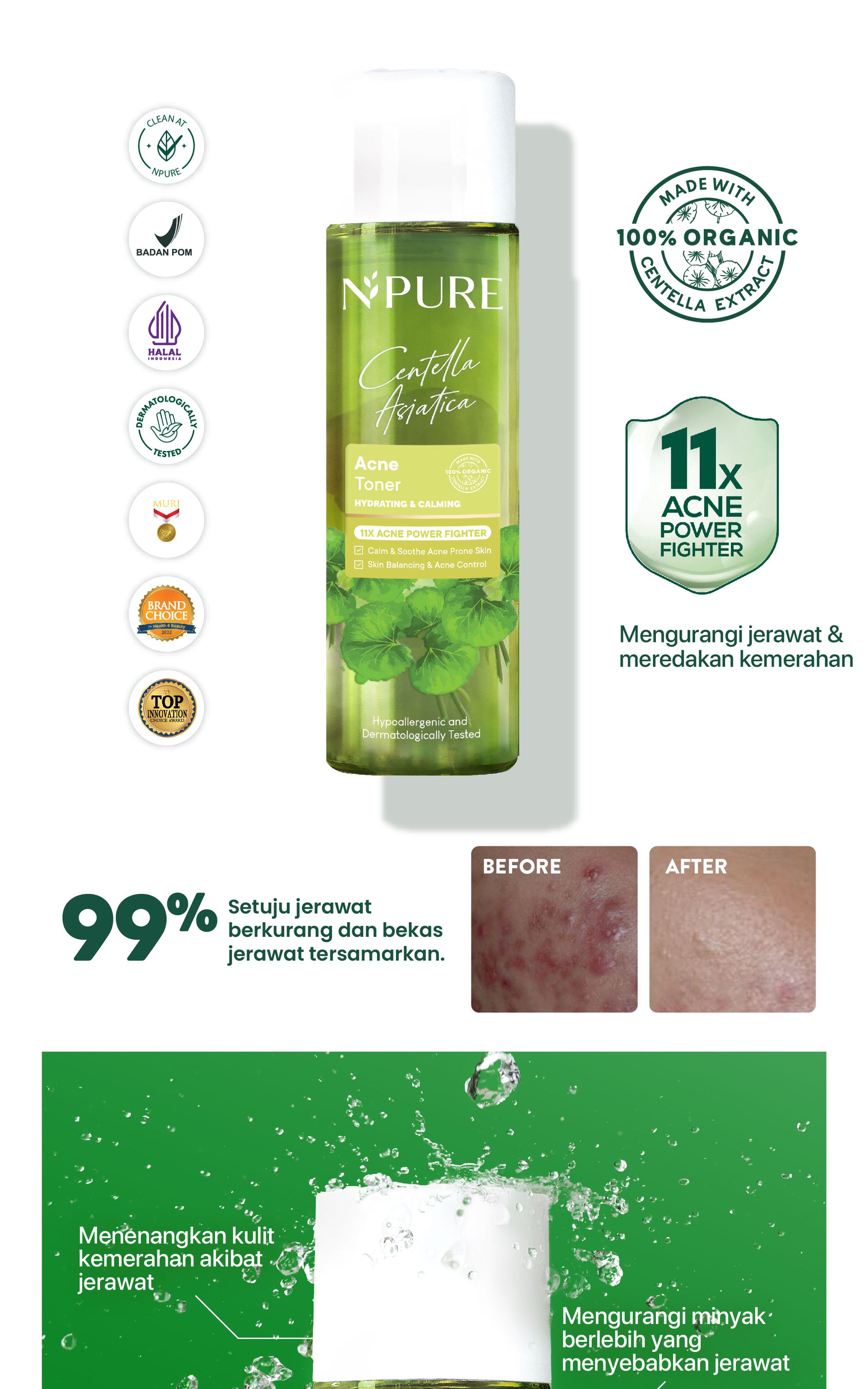 NPURE Cica Hydrating Acne Toner 30ml / Acne Toner / Toner Kulit Jerawat Berminyak - Travel Size Acid Berjerawat Hydrating Mencerahkan Wajah Kotoran