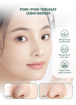 YOU AcnePlus 5X Acids Exfoliating Pads Pads Anti Jerawat Eksfoliasi Kulit Berminyak Bebas Jerawat 30 pads