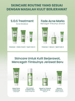 YOU AcnePlus 5X Acids Exfoliating Pads Pads Anti Jerawat Eksfoliasi Kulit Berminyak Bebas Jerawat 30 pads