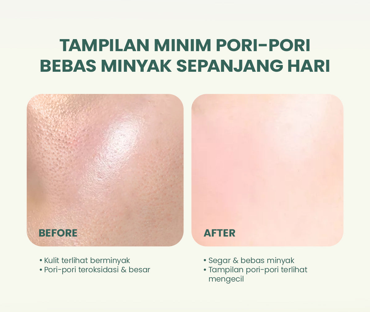 YOU AcnePlus AHA BHA PHA Daily Essence Toner Kulit Berminyak Jerawat Centella dan Oil Control