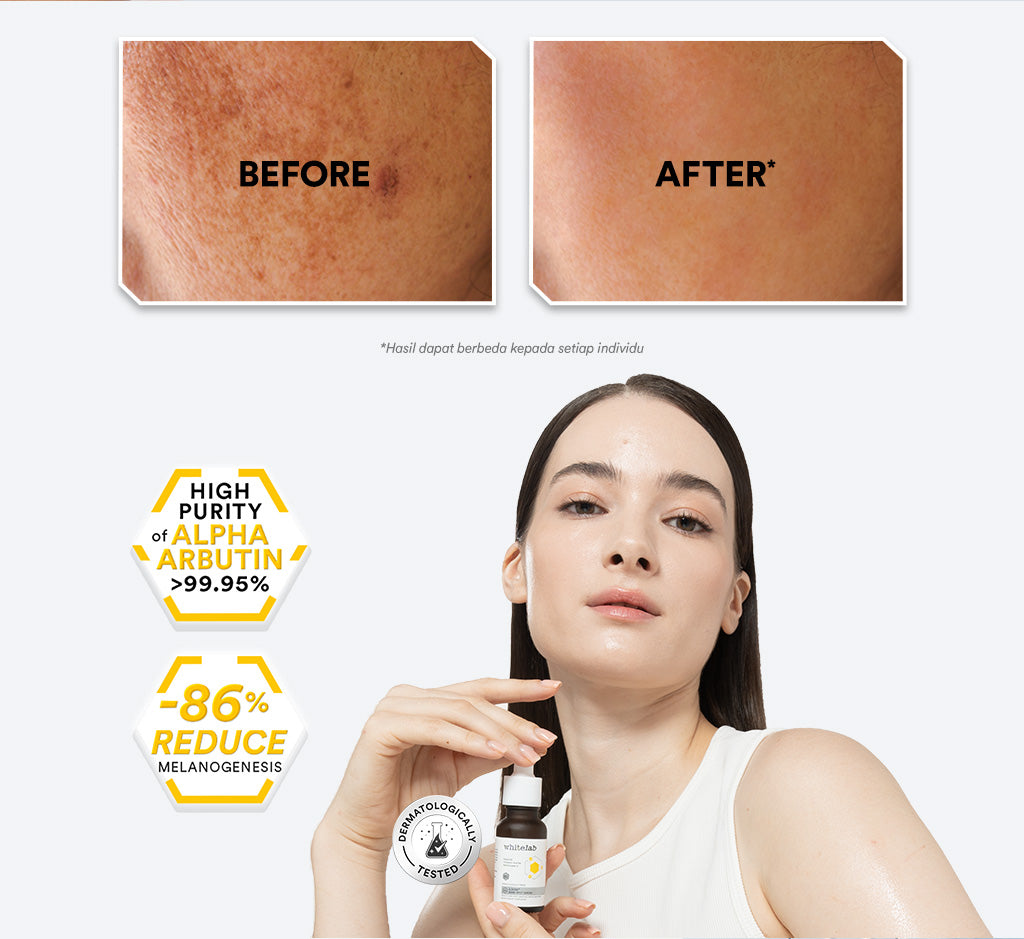 Whitelab Serum Arbutin Anti Dark Spot Flek Hitam - Serum Glowing Pencerah Wajah Bekas Jerawat