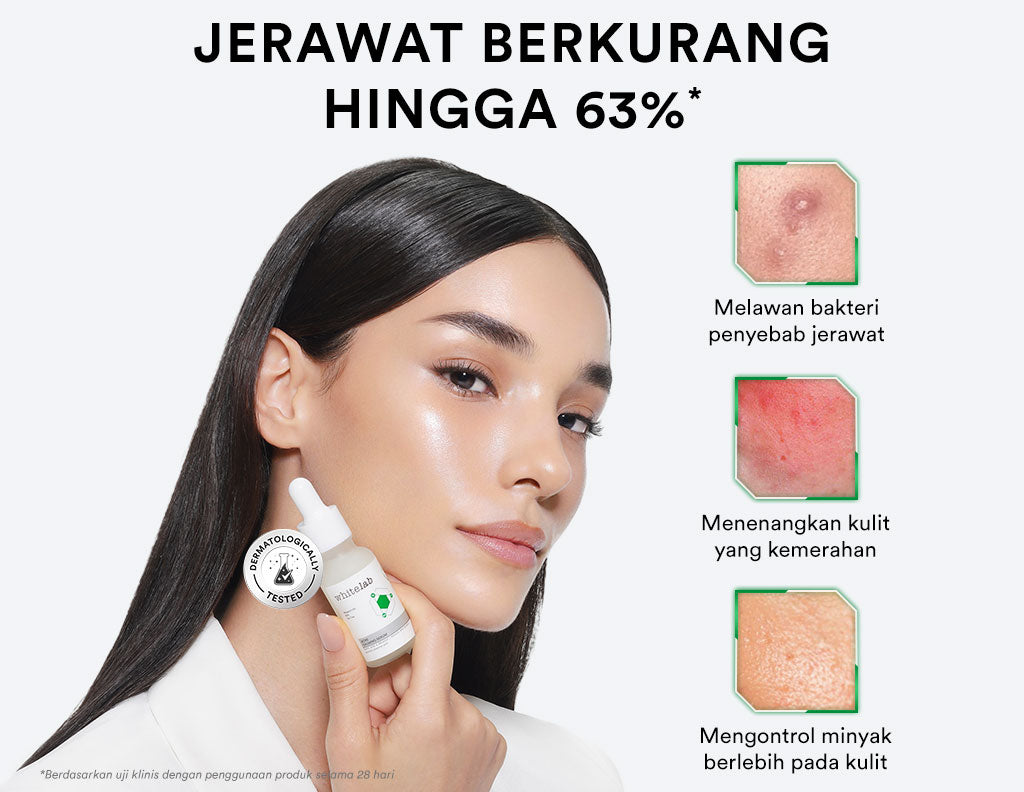 Whitelab Acne Calming Serum - Serum untuk Kulit Jerawat, Bruntusan, dan Berminyak dengan Mugwort, BHA & Tea Tree [BPOM]