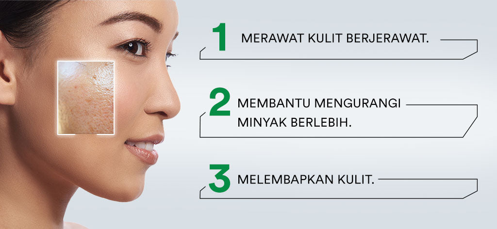 Whitelab Acne Toner - Toner Untuk Kulit Jerawat Menenangkan dan Mengontrol Minyak Berlebih dengan Bha, Mugwort & Tea Tree [BPOM]