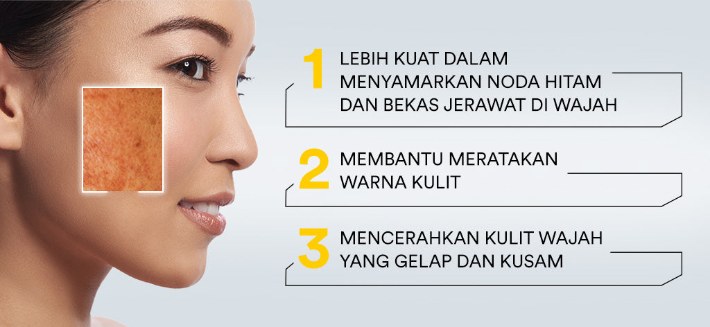 Whitelab Serum Arbutin Anti Dark Spot Flek Hitam - Serum Glowing Pencerah Wajah Bekas Jerawat