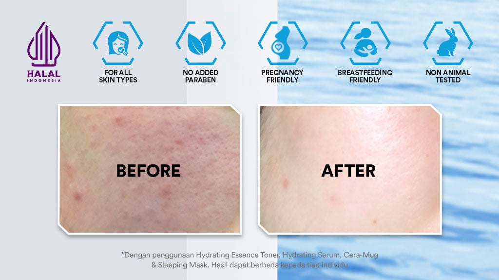 Whitelab Hydrating Sleeping Mask - Pelembap Malam untuk Kulit Lembap, Kenyal, Terhidrasi Maksimal dengan Hyaluronic, Panthenol & Grape Fruit Extract [BPOM]