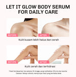 Lavojoy Let It Glow Body Serum Skin Brightening Upgraded Version | Body Serum Untuk Mencerahkan Dan Melembabkan Kulit Dengan Niacinamide + Ceramide + Vitamin E