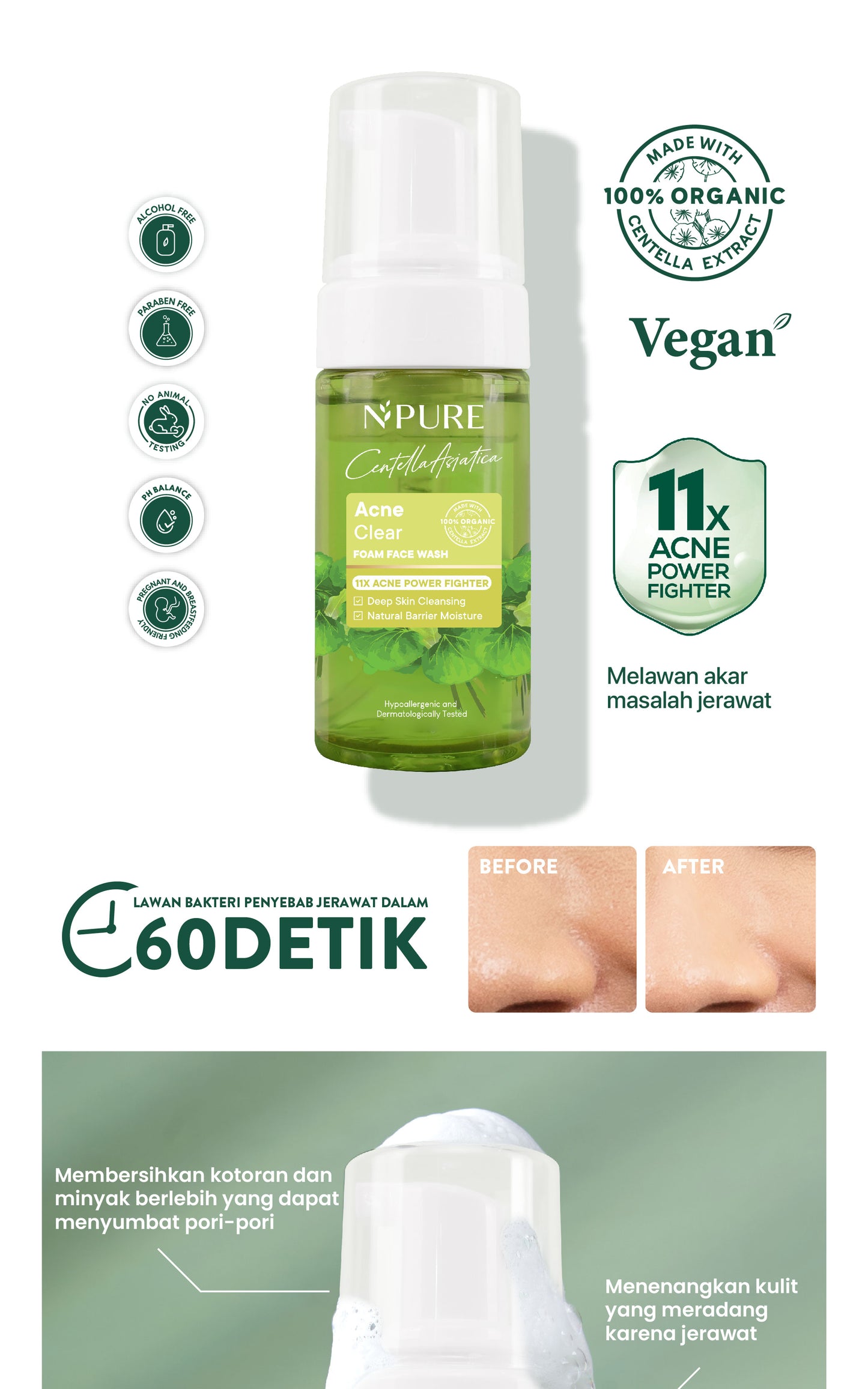 NPURE Facial Wash Cica / Anti Acne Facial Foam / Sabun Muka Anti Jerawat Berminyak