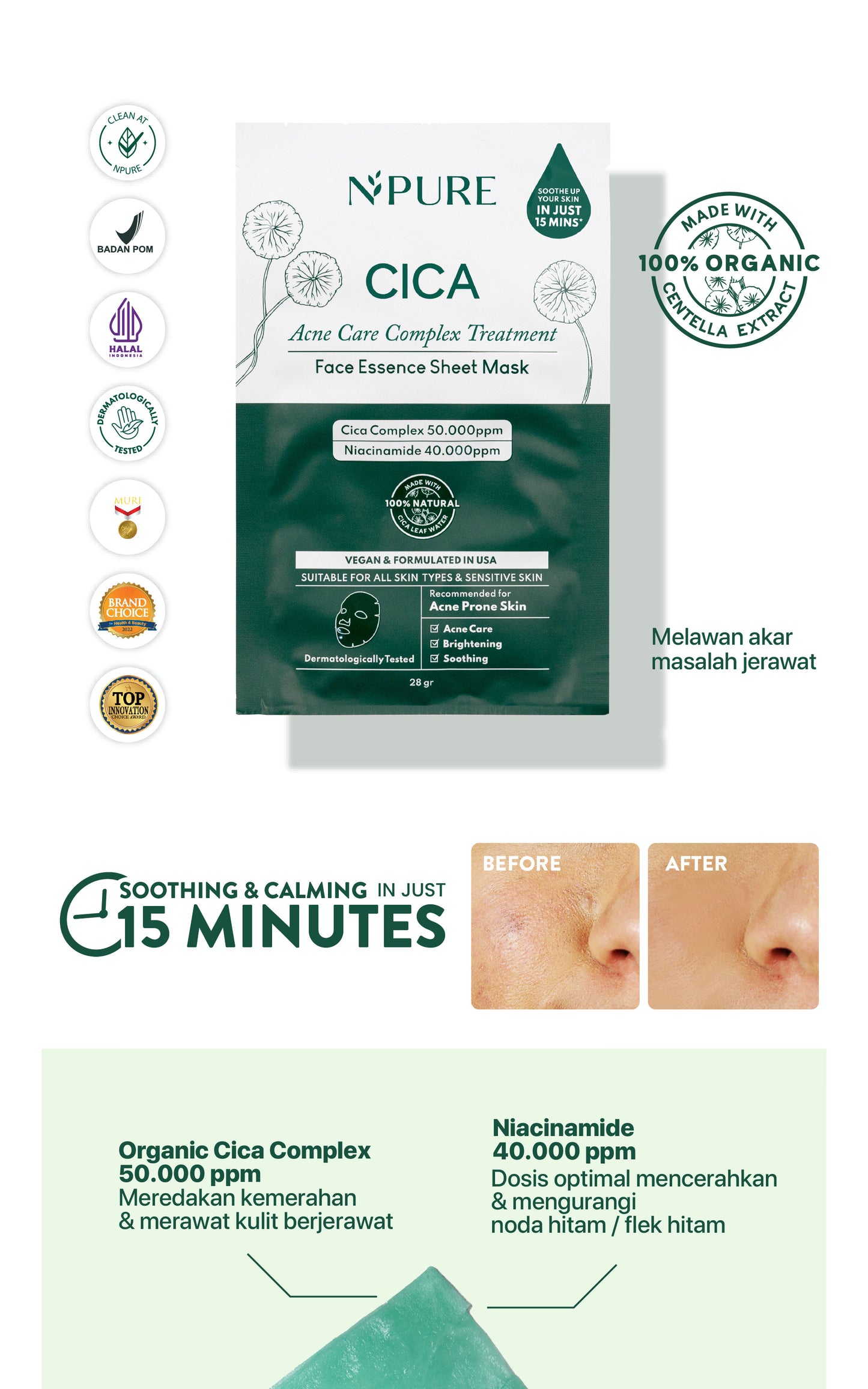 NPURE Sheet Mask Cica / Anti Acne Sheet Mask / Masker Wajah Anti Jerawat