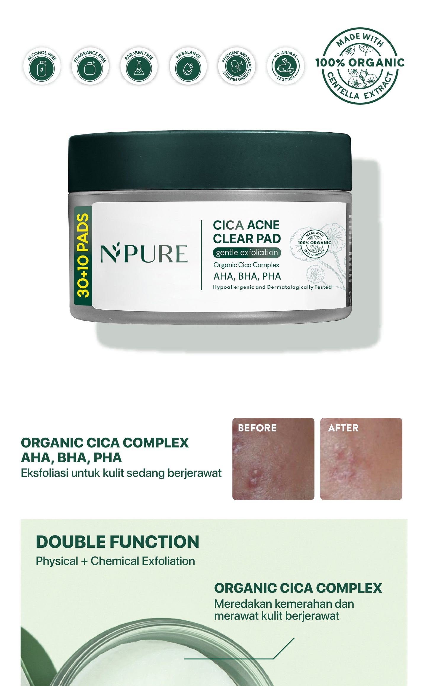 GENTLE EXFOLIATION PAD CICA  -  NPURE Acne Clear Pad Cica / Kapas Eksfoliasi Kulit Jerawat / Acne Exfoliating Pad (40 pads) Acid Extract Glycolic Pha Wajah Bruntusan