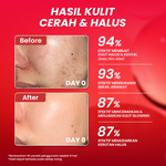 Hanasui Advance Retinol Serum -  Anti Aging Serum untuk Kerutan Halus Tekstur Kulit Cerah Kenyal Encapsulated Retinol, HPR, Advance Niacinamide, 5X Ceramide