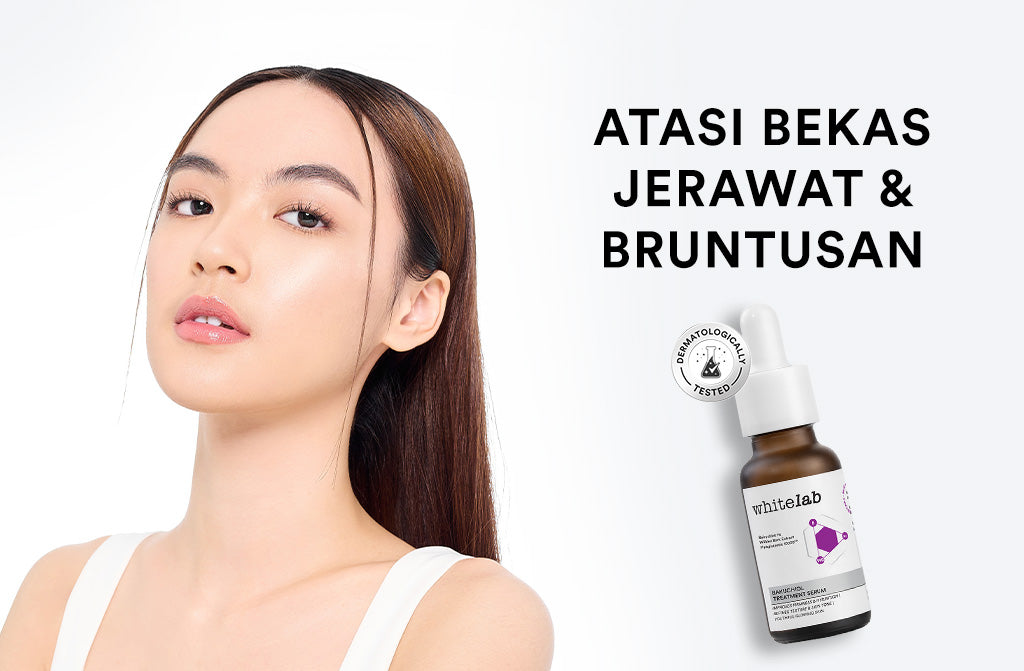 Whitelab Bakuchiol Treatment Serum - Atasi Jerawat dan Bruntusan Alternatif Retinol dengan Bakuchiol & Hyaglutamic [BPOM]