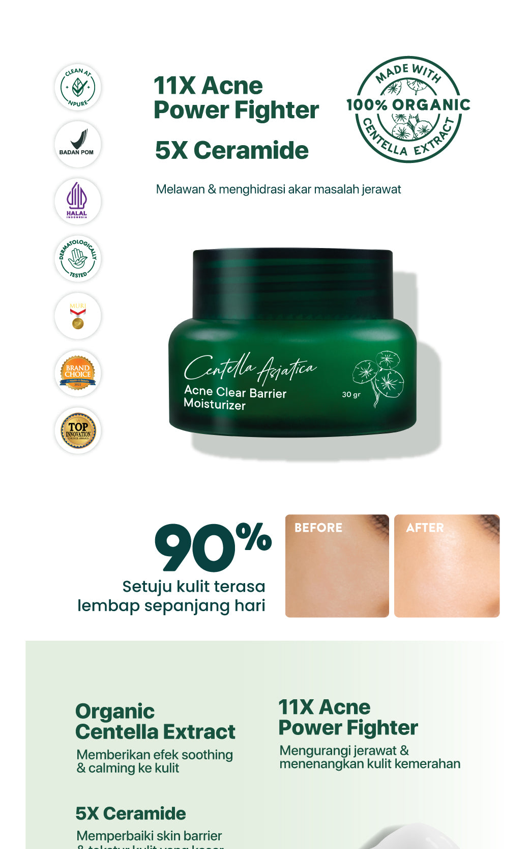 NPURE Centella Asiatica Acne Clear Barrier Moisturizer / Acne Moisturizer/ Pelembap Kulit Jerawat / Krim Berjerawat