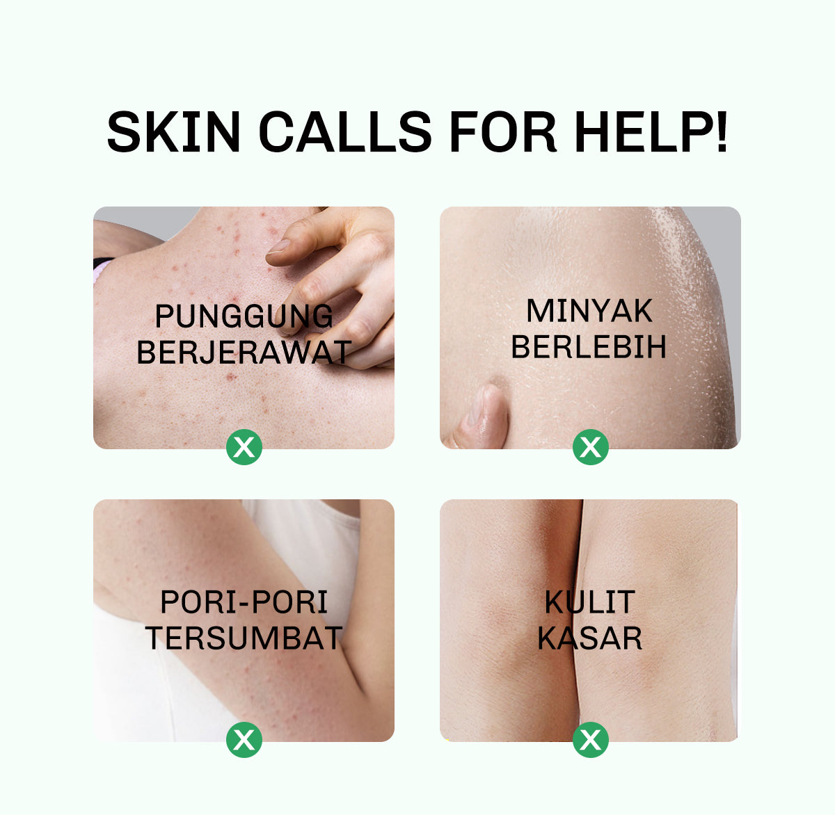 Lavojoy Solve It Now Body Wash | Sabun Mandi Cair Untuk Melembabkan Kulit Sensitif,  Merawat Kulit Berjerawat Dan Menghaluskan Tekstur Kulit Kasar | Mengandung Amino Acid, AHA, BHA Dan Zinc PCA