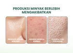YOU AcnePlus AHA BHA PHA Daily Essence Toner Kulit Berminyak Jerawat Centella dan Oil Control