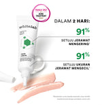 Whitelab Acne Cream - Krim Totol Atasi Jerawat dalam 2 Hari dengan Sulfur, Calamine & Mugwort [BPOM]