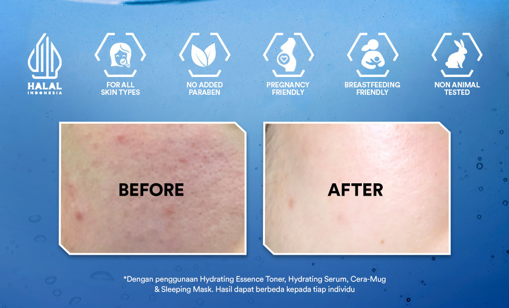 [BUY 1 GET 1] Whitelab Hydrating Serum - Serum Kulit Kering Perkuat Hidrasi untuk Kulit Lembap, Halus & Kenyal dengan Hyaluronic, Panthenol & Probiotic [BPOM]