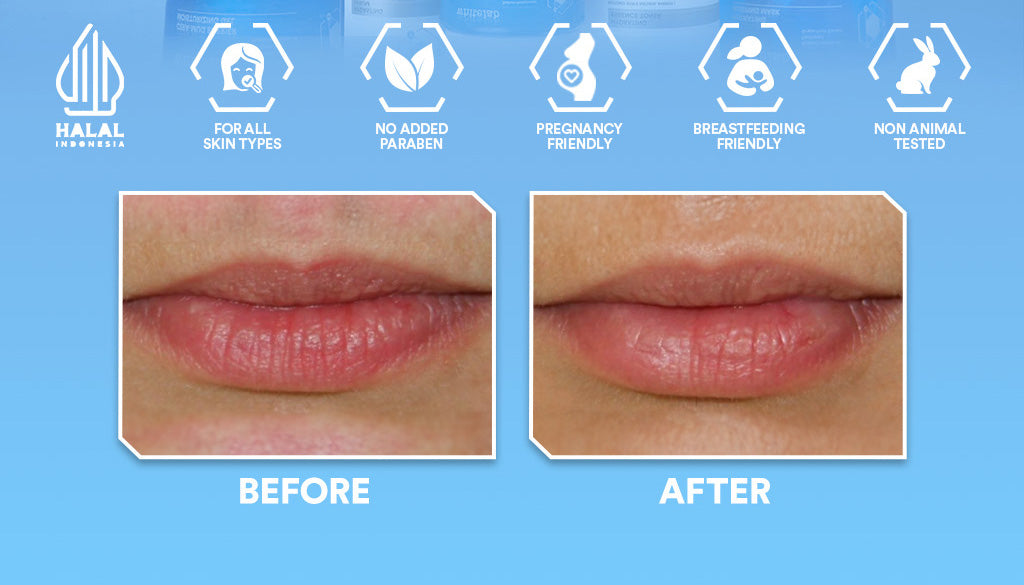 Whitelab Hydrating Series - Facial Cleanser, Essence Toner, Serum, Moisturizer, Sleeping Mask Paket Skincare