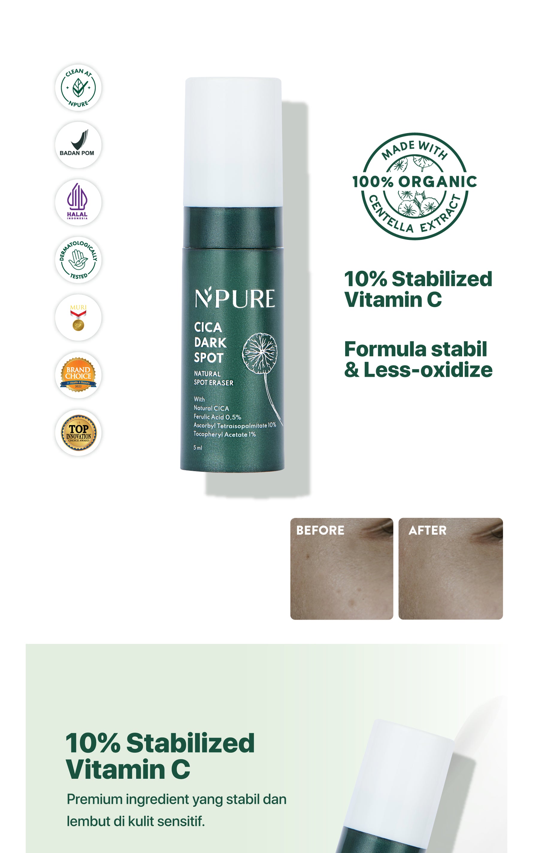 DARK SPOT - NPURE Spot Treatment Dark Spot / Menyamarkan noda hitam bekas jerawat
