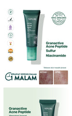 ACNE SPOT - NPURE Spot Treatment Acne Spot / Totol Jerawat