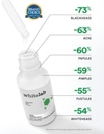 Whitelab 4 pcs Paket Acne - Facial Wash, Toner, Serum, Moisturizer Paket Skincare