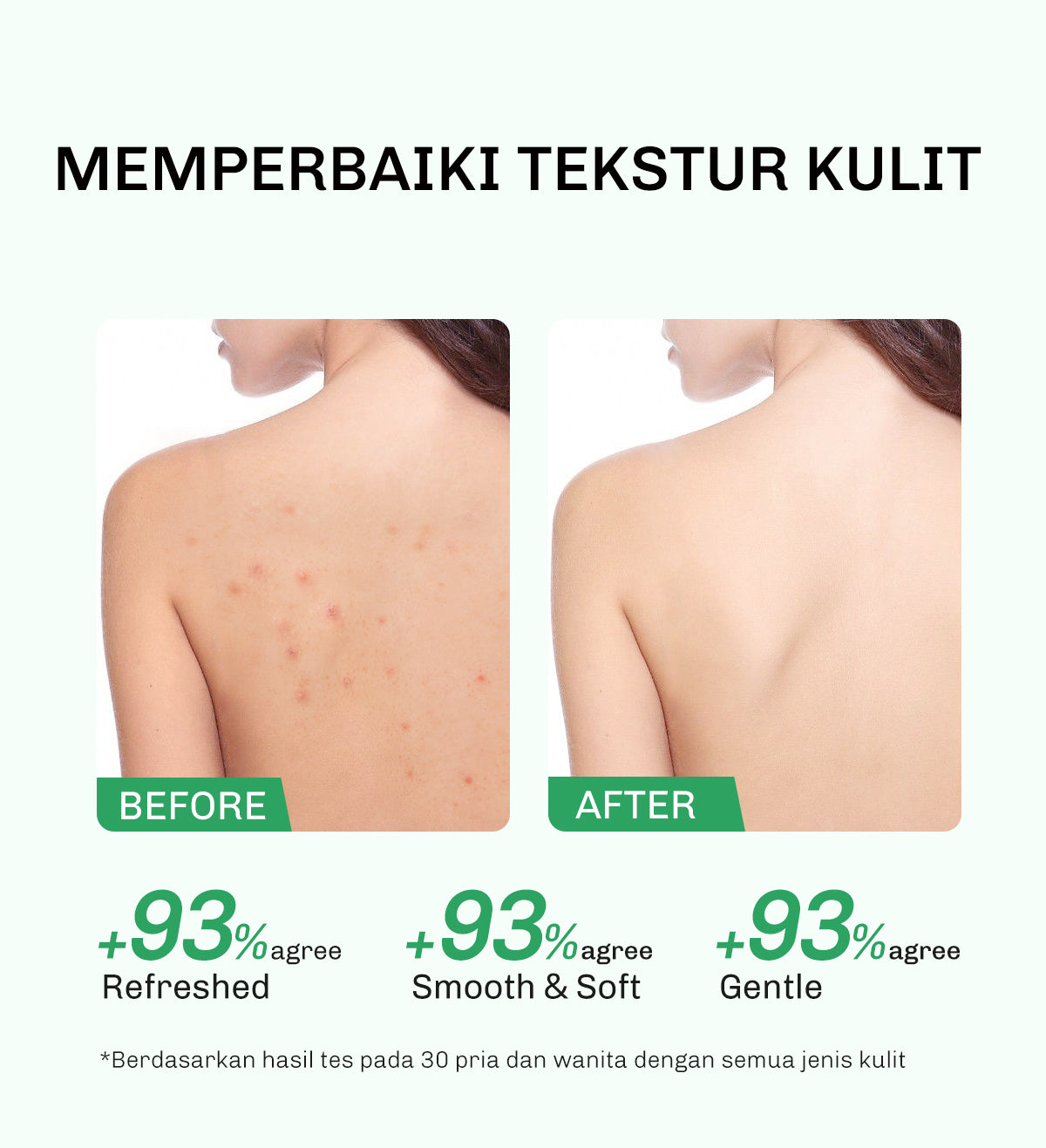 Lavojoy Solve It Now Body Wash | Sabun Mandi Cair Untuk Melembabkan Kulit Sensitif,  Merawat Kulit Berjerawat Dan Menghaluskan Tekstur Kulit Kasar | Mengandung Amino Acid, AHA, BHA Dan Zinc PCA