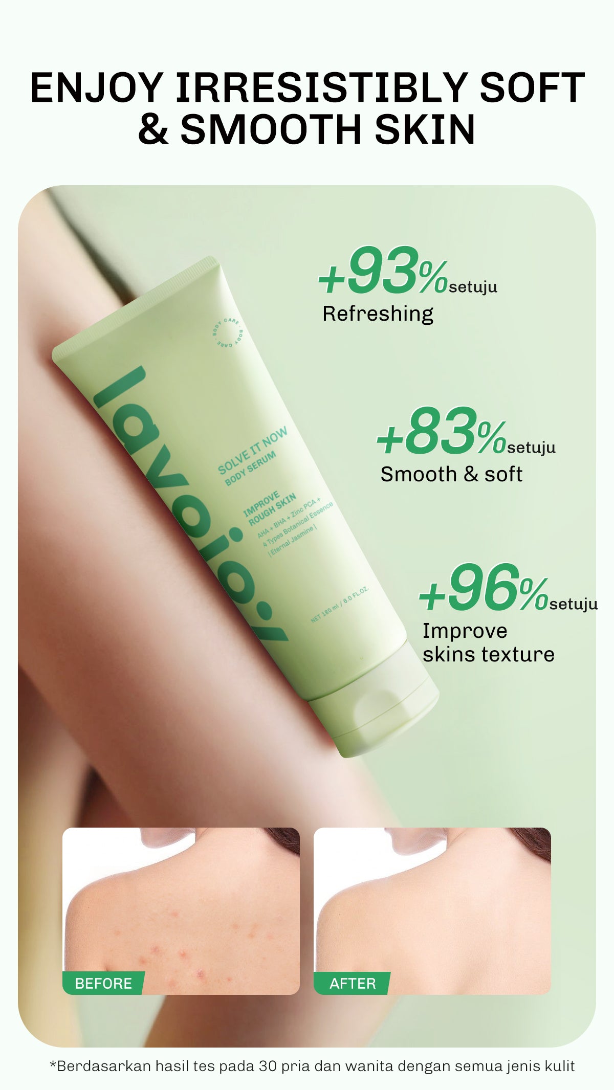 Lavojoy Solve It Now Body Serum | Body Lotion Untuk Melembabkan Kulit Sensitif,  Merawat Kulit Berjerawat, Menghaluskan Tekstur Kulit Kasar Dan Anti Jerawat | Mengandung Amino Acid, AHA, BHA Dan Zinc PCA